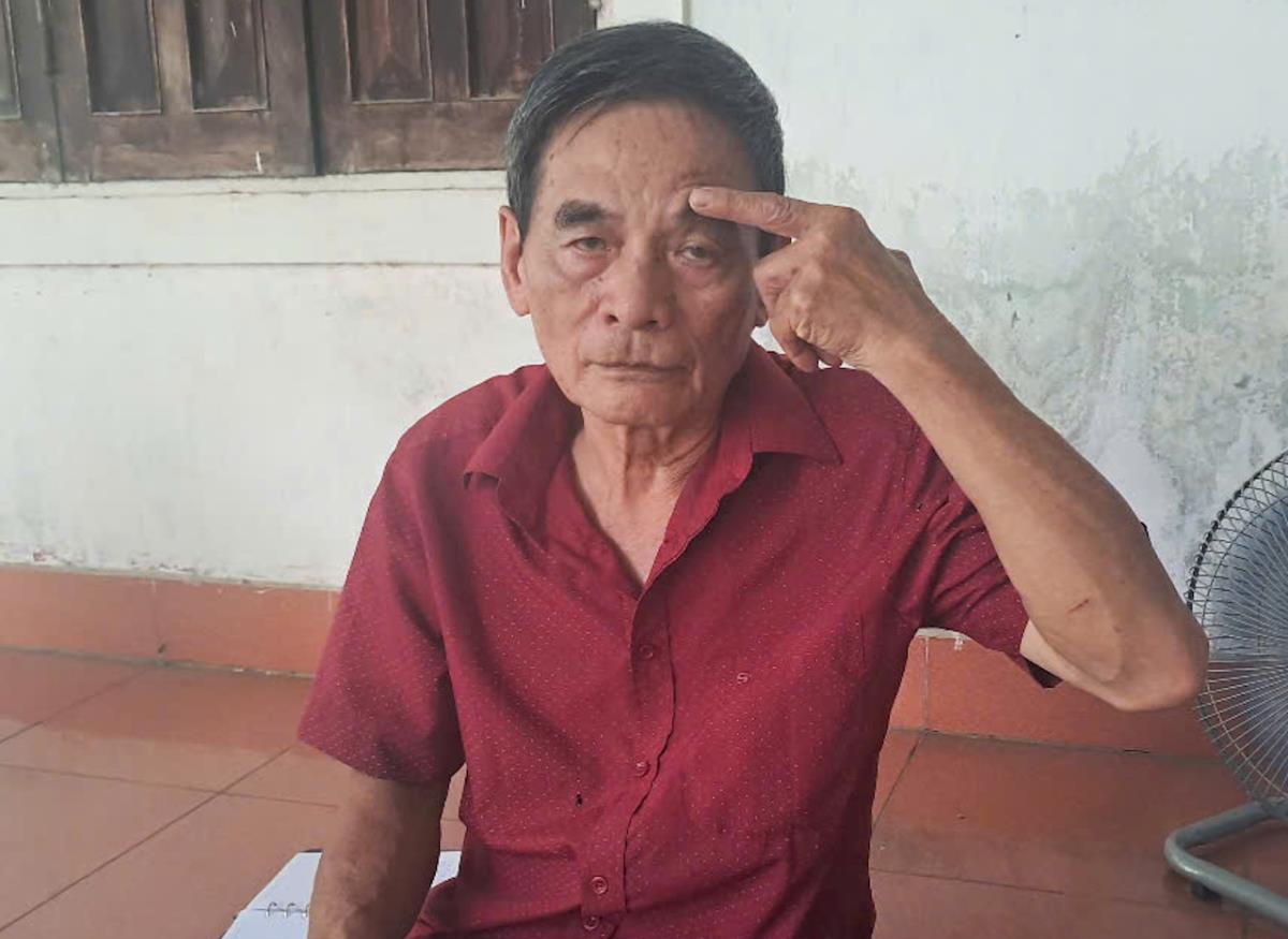 Vết thương trên trán ông Mừng phải khâu 8 mũi.