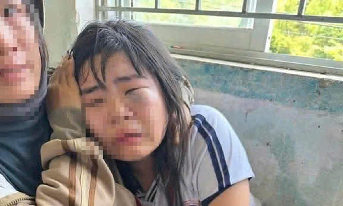 Em B. bị đánh bầm tím, hoảng loạn.