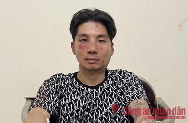 Đối tượng đâm trọng thương Công an bị tạm giữ về hành vi cướp tài sản, chống người thi hành công vụ