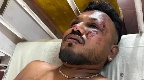 Rơi máy bay chở 242 người ở Ấn Độ: Sống sót kỳ diệu nhờ nhảy khỏi máy bay?