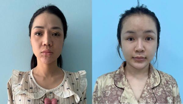 Lần theo dấu vết ảo, bóc gỡ đường dây ma túy trên mạng xã hội