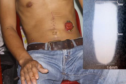 Thông tin mới về vụ nổ súng ở đường Xô viết Nghệ Tĩnh (Đà Nẵng): 24 ngày, đêm theo dấu Hiếu chém và đồng bọn