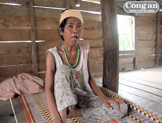 Chuyện buồn mang tên ma lai, thuốc thư