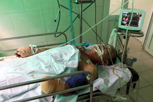 Mìn nổ tại nhà anh cọc chèo