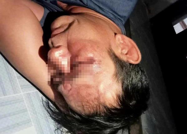 Triệu tập 7 người đánh người đàn ông bất tỉnh, nguyên nhân nghi do bài thơ đăng Facebook