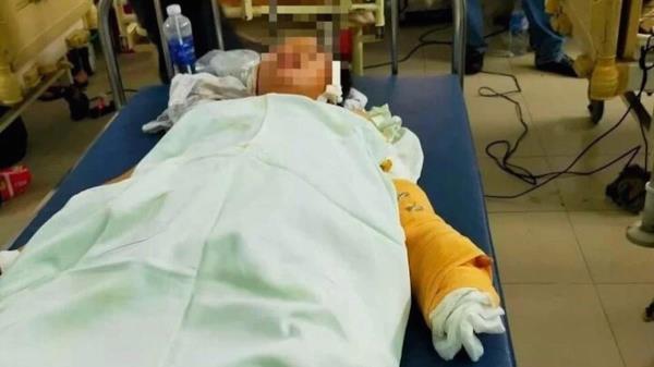 Tấn công bạn gái và mẹ rồi phóng hoả đốt nhà