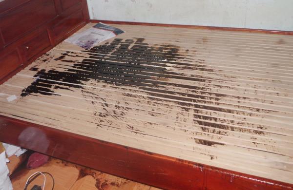 Sát hại chồng bằng a-xít