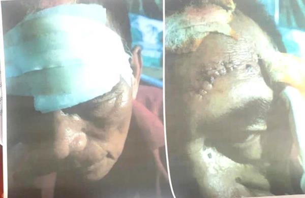 Công an điều tra sự việc một thương binh tố bị tác động gây chấn thương