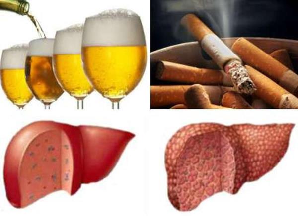 Hút thuốc lá và bệnh gan