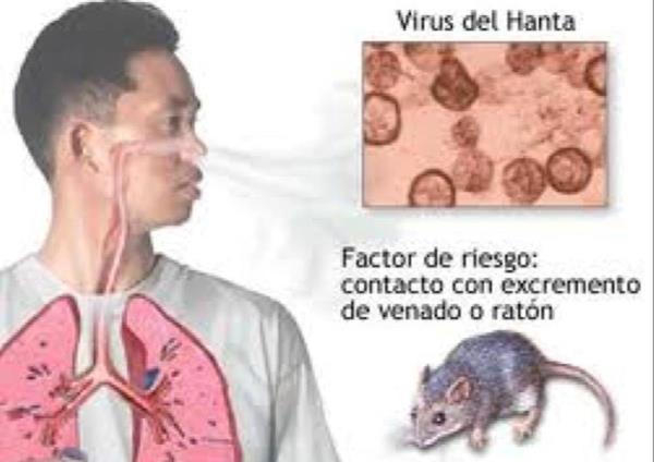 Bộ Y tế lên tiếng về virus Hanta