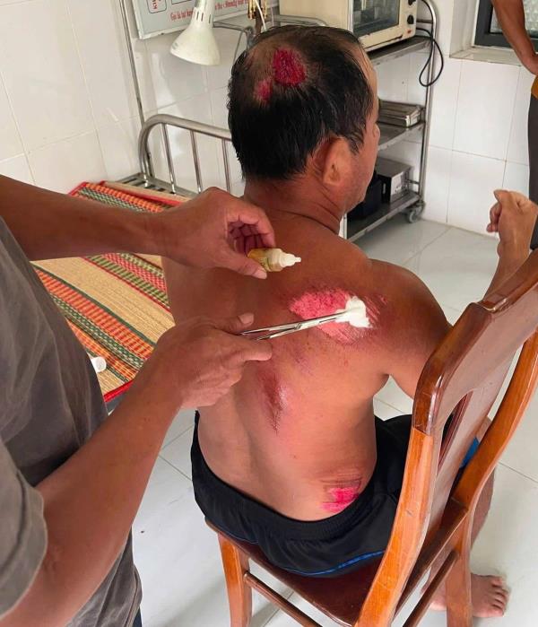 Ngư dân câm điếc bị tàu lạ tông chìm thuyền rồi bỏ mặc giữa biển