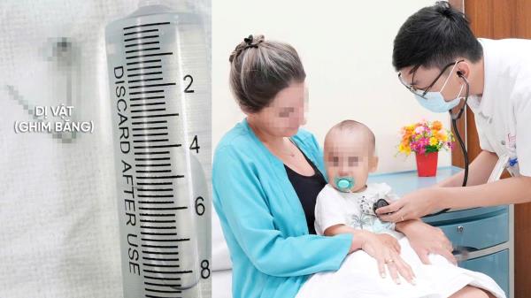 Gắp kim băng khỏi thực quản bé 9 tháng tuổi