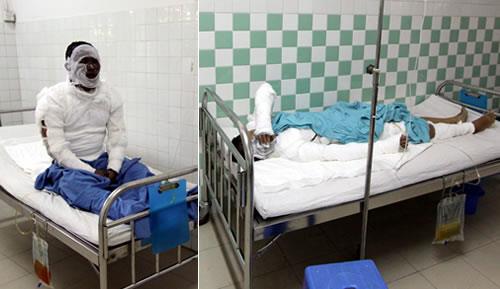 Thông tin về đôi tình nhân bị tạt a-xít