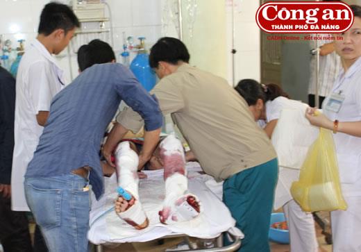 Nổ trên xe khách, 3 người bị thương