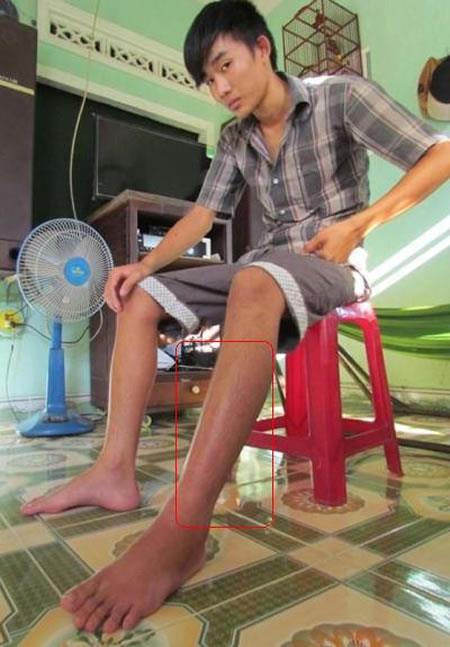 Rắn lục đuôi đỏ liên tục tấn công người