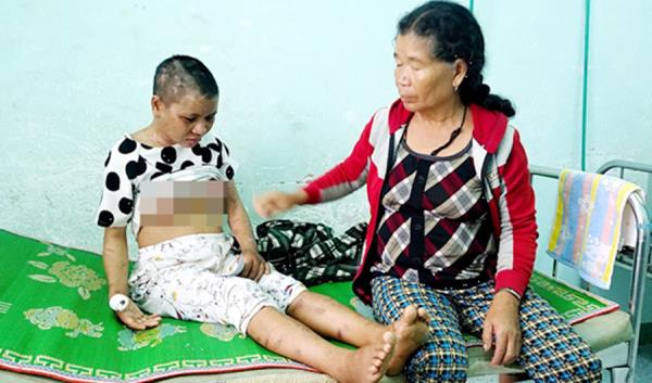 Điều tra vụ cô gái bị chủ tra tấn như thời Trung cổ